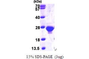 Deoxyuridine Triphosphatase (DUT) (AA 70-252) protein (His tag)