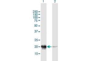Western Blot analysis of PDC expression in transfected 293T cell line by PDC MaxPab polyclonal antibody. (Phosducin 抗体  (AA 1-194))
