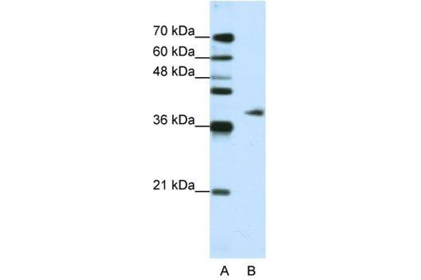 ADAT1 抗体  (C-Term)
