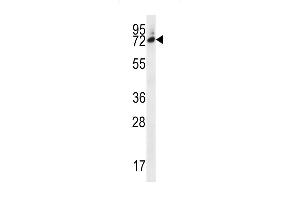 SIX5 Antibody (Center) (ABIN656668 and ABIN2845908) western blot analysis in MDA-M cell line lysates (35 μg/lane). (Six5 抗体  (AA 257-286))