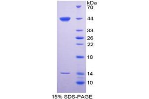SDS-PAGE analysis of Rat SPD Protein. (SFTPD 蛋白)