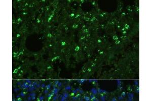 Immunofluorescence analysis of Mouse lung cells using TREM2 Polyclonal Antibody at dilution of 1:100. (TREM2 抗体)