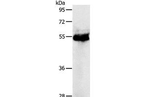 Western Blot analysis of Human colon cancer tissue using PRKAR1B Polyclonal Antibody at dilution of 1:1200 (PRKAR1B 抗体)