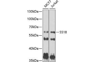 Western blot analysis of extracts of various cell lines, using SS18 antibody (ABIN6133185, ABIN6148473, ABIN6148474 and ABIN6222754) at 1:1000 dilution. (SS18 抗体  (AA 1-240))