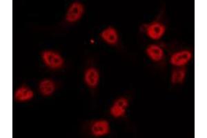 ABIN6274520 staining Hela by IF/ICC. (AKIP1 抗体  (Internal Region))