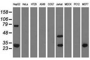 Image no. 2 for anti-Quinolinate Phosphoribosyltransferase (QPRT) antibody (ABIN1500534) (QPRT 抗体)