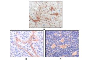 Immunohistochemical analysis of paraffin-embedded human cerebrum tumor (A), endothelium of vessel (B), lymphocyte of thymus(C), showing cytoplasmic localization using FES mouse mAb with DAB staining. (FES 抗体)
