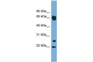 WB Suggested Anti-MMP26  Antibody Titration: 0. (MMP26 抗体  (C-Term))