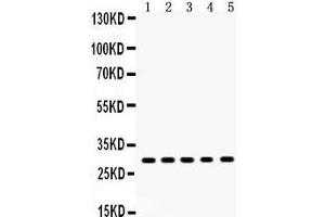 Anti- XBP Picoband antibody, Western blotting All lanes: Anti XBP1  at 0. (XBP1 抗体  (N-Term))
