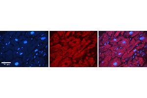 Rabbit Anti-ATXN2 Antibody   Formalin Fixed Paraffin Embedded Tissue: Human heart Tissue Observed Staining: Cytoplasmic Primary Antibody Concentration: N/A Other Working Concentrations: 1:600 Secondary Antibody: Donkey anti-Rabbit-Cy3 Secondary Antibody Concentration: 1:200 Magnification: 20X Exposure Time: 0. (Ataxin 2 抗体  (Middle Region))