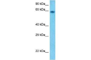 Host:  Rabbit  Target Name:  GUCY1B3  Sample Tissue:  Human HepG2 Whole cell  Antibody Dilution:  1ug/ml (GUCY1B3 抗体)