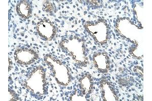 UBE2J1 antibody was used for immunohistochemistry at a concentration of 4-8 ug/ml to stain Alveolar cells (arrows) in Human Lung. (UBE2J1 抗体)