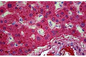 Human Liver: Formalin-Fixed, Paraffin-Embedded (FFPE) (APOA2 抗体)