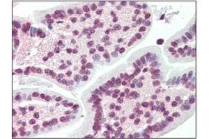 Immunohistochemistry (IHC) image for anti-X-Box Binding Protein 1 (XBP1) (AA 2-160) antibody (ABIN492538) (XBP1 抗体  (AA 2-160))