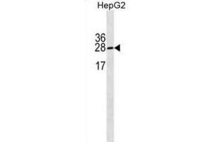 Western Blotting (WB) image for anti-Immunoglobulin lambda-Like Polypeptide 5 (IGLL5) antibody (ABIN3000244) (IGLL5 抗体)