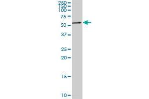 MEF2A monoclonal antibody (M08), clone 1F8. (MEF2A 抗体  (AA 71-170))