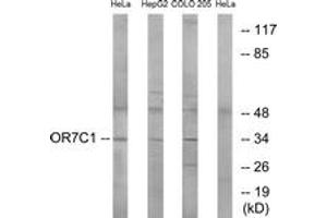 Western Blotting (WB) image for anti-Olfactory Receptor, Family 7, Subfamily C, Member 1 (OR7C1) (AA 199-248) antibody (ABIN1535954)
