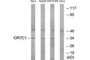 Western blot analysis of extracts from HeLa/HepG2/COLO cells, using OR7C1 Antibody. (OR7C1 抗体  (AA 199-248))