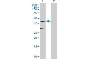 Western Blot analysis of ACOT7 expression in transfected 293T cell line by ACOT7 MaxPab polyclonal antibody. (ACOT7 抗体  (AA 1-380))