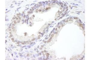 Immunohistochemistry (IHC) image for anti-Ubiquitin Specific Peptidase 47 (USP47) (C-Term) antibody (ABIN7449031) (USP47 抗体  (C-Term))