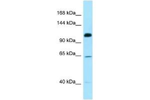 WB Suggested Anti-SMC6 Antibody Titration: 1. (SMC6 抗体  (C-Term))
