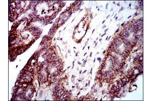 Immunohistochemistry (IHC) image for anti-Integrin beta 1 (ITGB1) antibody (ABIN1844058) (ITGB1 抗体)