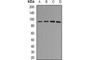 Western blot analysis of MDM2 expression in SHSY5Y (A), A549 (B), rat brain (C), rat lung (D) whole cell lysates. (MDM2 抗体)