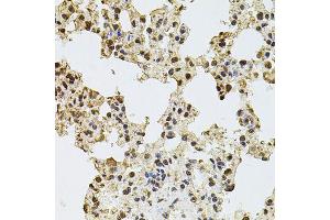 Immunohistochemistry of paraffin-embedded rat lung using ZNF408 antibody (ABIN5974874) at dilution of 1/100 (40x lens). (ZNF408 抗体)