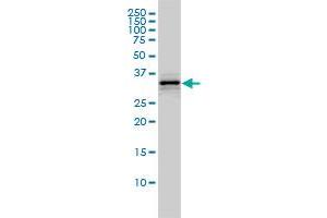 HMGCL monoclonal antibody (M01), clone 4F4-D1 Western Blot analysis of HMGCL expression in A-431 (HMGCL 抗体  (AA 1-325))