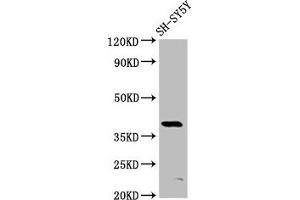 Western Blot Positive WB detected in: SH-SY5Y whole cell lysate All lanes: MKX antibody at 6 μg/mL Secondary Goat polyclonal to rabbit IgG at 1/50000 dilution Predicted band size: 40 kDa Observed band size: 40 kDa (MKX 抗体  (AA 157-305))