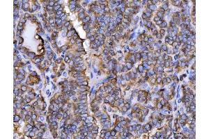 IHC analysis of ERP29 using anti-ERP29 antibody (ABIN7601342). (ERP29 抗体  (AA 33-196))