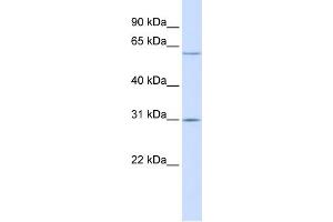 WB Suggested Anti-TMEM106C Antibody Titration:  0. (TMEM106C 抗体  (Middle Region))