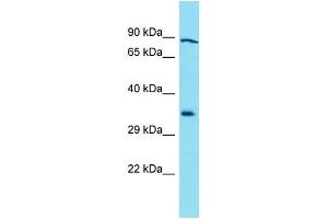 Western Blotting (WB) image for anti-Galactosidase, beta 1-Like 3 (GLB1L3) (C-Term) antibody (ABIN2791555) (GLB1L3 抗体  (C-Term))