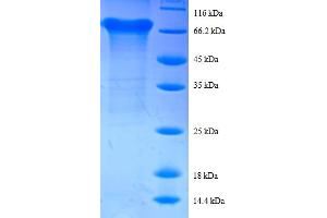 SDS-PAGE (SDS) image for Eukaryotic Translation Initiation Factor 4A2 (EIF4A2) (AA 1-407), (full length) protein (GST tag) (ABIN5712053)