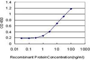Detection limit for recombinant GST tagged IRAK3 is approximately 0. (IRAK3 抗体  (AA 497-596))
