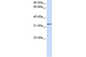 DOK5 antibody used at 1 ug/ml to detect target protein. (DOK5 抗体  (N-Term))