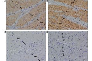 Immunohistochemistry (IHC) image for anti-omega-3 Fatty Acid Receptor 1 (O3FAR1) (N-Term) antibody (ABIN2854731)