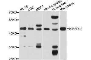 Western blot analysis of extracts of various cell lines, using KIR3DL2 antibody (ABIN4904158) at 1:1000 dilution. (KIR3DL2 抗体)