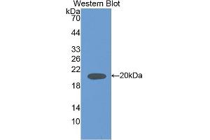 Detection of Recombinant IL18, Rat using Polyclonal Antibody to Interleukin 18 (IL18) (IL-18 抗体  (AA 37-194))