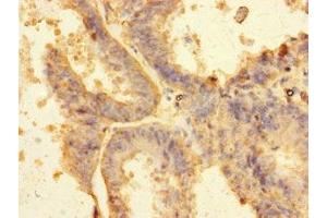 Immunohistochemistry of paraffin-embedded human endometrial tissue using ABIN7151123 at dilution of 1:100 (RNF13 抗体  (AA 432-685))