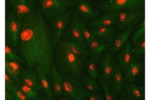 IF analysis of SMC1A and Tubulin beta using anti-SMC1A antibody (ABIN7602089) and anti-Tubulin beta antibody (ABIN7602744). (SMC1A 抗体  (AA 59-1233))