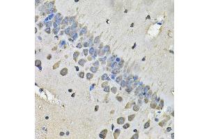 Immunohistochemistry (Paraffin-embedded Sections) (IHC (p)) image for anti-Myosin Heavy Chain 1, Skeletal Muscle, Adult (MYH1) (AA 1-100) antibody (ABIN6144230)