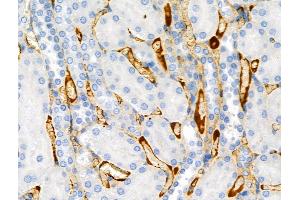 Phospho-SIRT2 (Ser368) Antibody at 1/100 staining Rat kidney tissue by IHC-P.