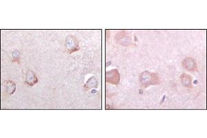 Immunohistochemistry (IHC) image for anti-Sortilin-Related Receptor, L(DLR Class) A Repeats Containing (SORL1) antibody (ABIN1724674)