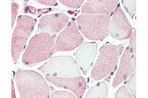 Anti-XK antibody IHC of human skeletal muscle. (Membrane transport protein XK (XK) (AA 22-38) 抗体)