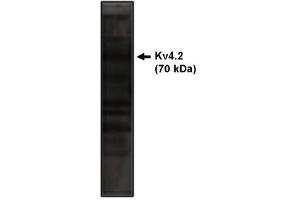 Image no. 1 for anti-Potassium Voltage-Gated Channel, Shal-Related Subfamily, Member 2 (KCND2) antibody (ABIN265029) (KCND2 抗体)