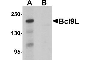 Western blot analysis of Bcl9L in HeLa cell lysate with Bcl9L antibody at 1 µg/mL in (A) the absence and (B) the presence of blocking peptide. (BCL9L 抗体  (N-Term))
