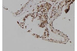 ABIN6276979 at 1/100 staining Rat lung tissue by IHC-P. (MCM6 抗体  (C-Term))