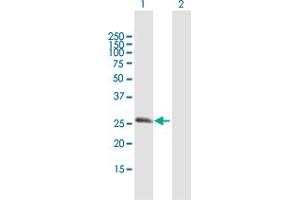 Western Blot analysis of RGS20 expression in transfected 293T cell line by RGS20 MaxPab polyclonal antibody. (RGS20 抗体  (AA 1-241))