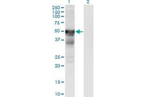 Western Blot analysis of RGMA expression in transfected 293T cell line by RGMA monoclonal antibody (M01), clone 6D7. (RGMA 抗体  (AA 326-423))